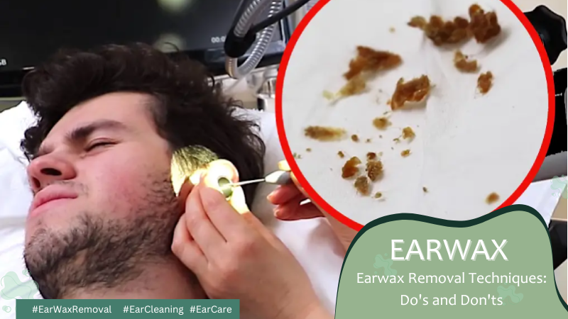 Earwax 1